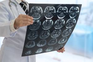 doctor with print out of brain mris