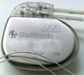 medtronic defibrillator recall lawsuit