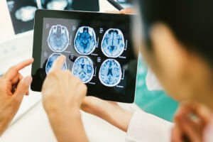 reviewing brain MRIs