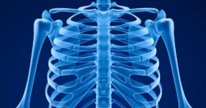 What Compensation Can I Recover For Broken Ribs From a Windsor, ON Car Crash?