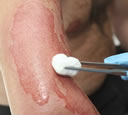 injury from faulty product